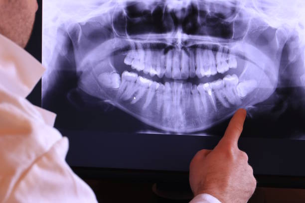 Best Emergency Dental Surgery in Republic, WA